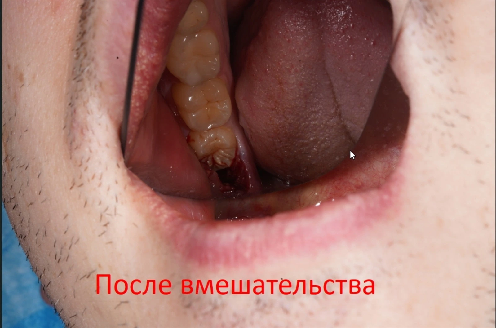 abclinic.uz, стоматология
