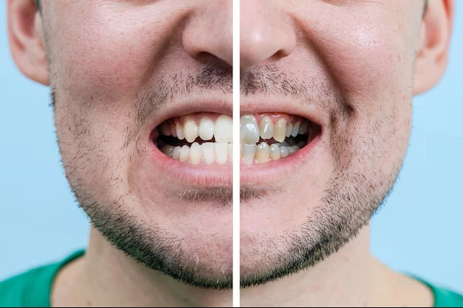 American dentistry, стоматология