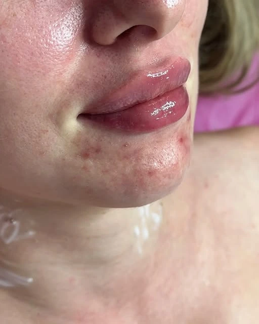 Angelina cosmetolog