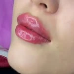 Aylin Estetic, центр косметологии