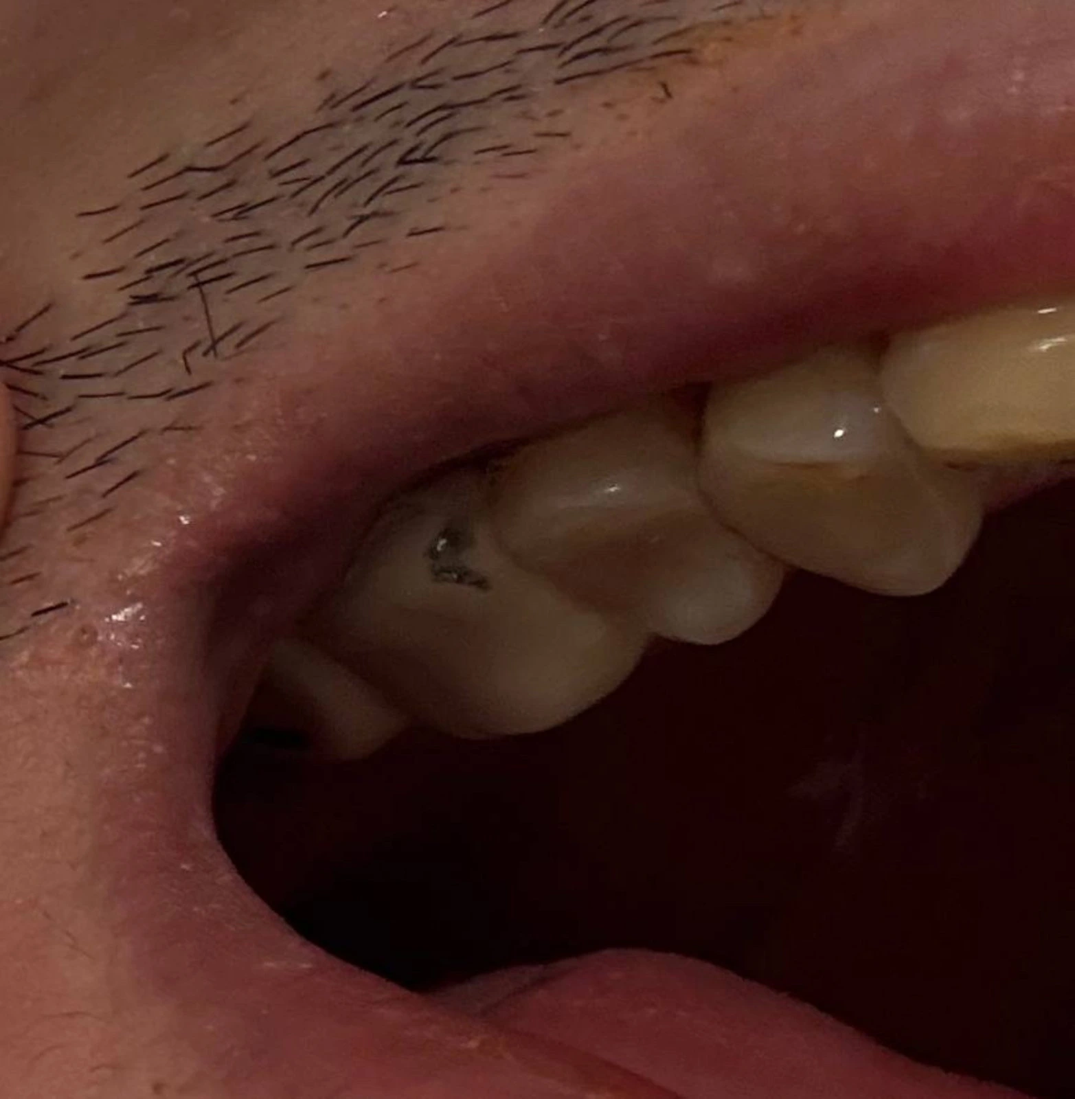 Denta service