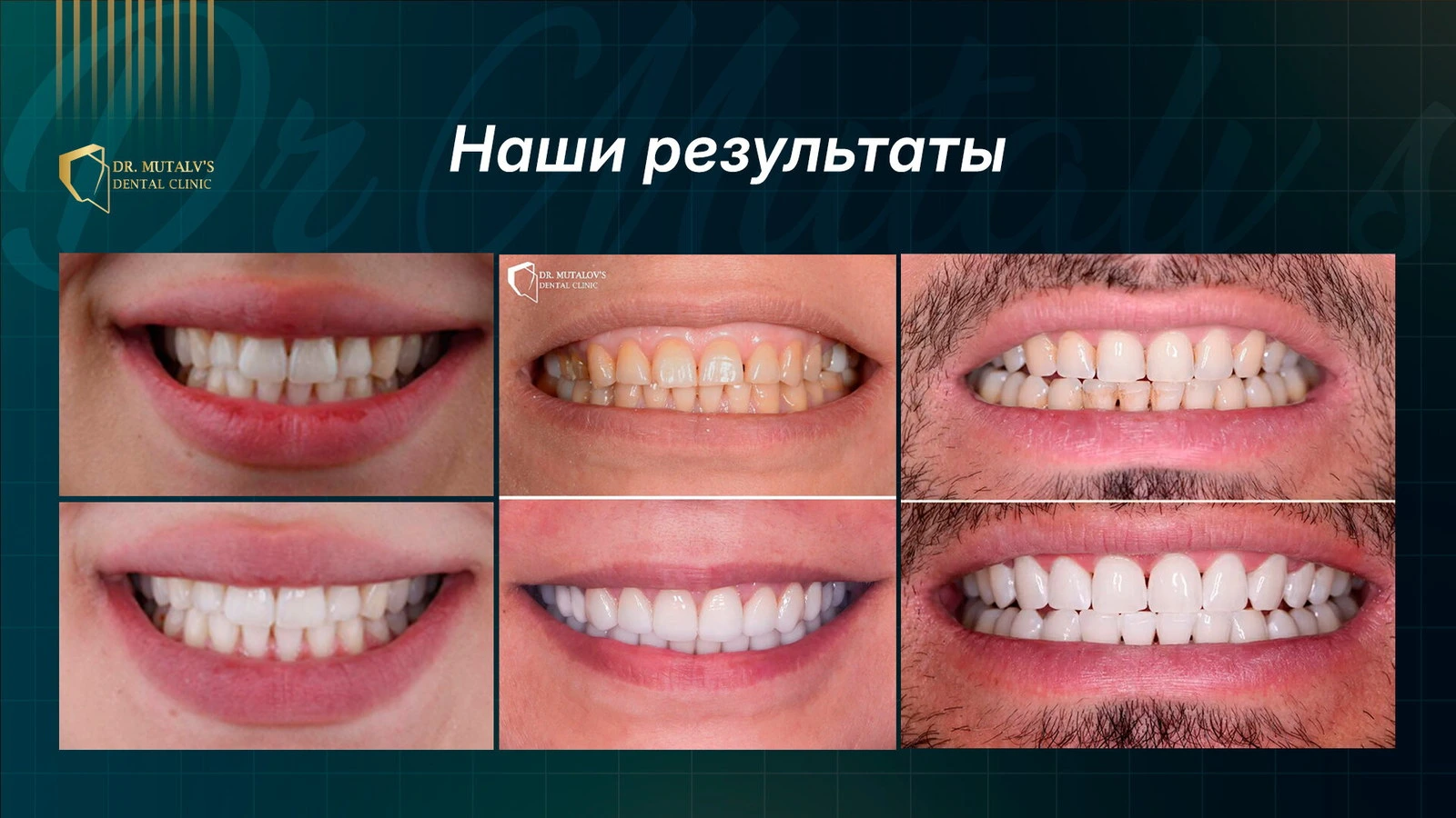 Dr.Mutalov