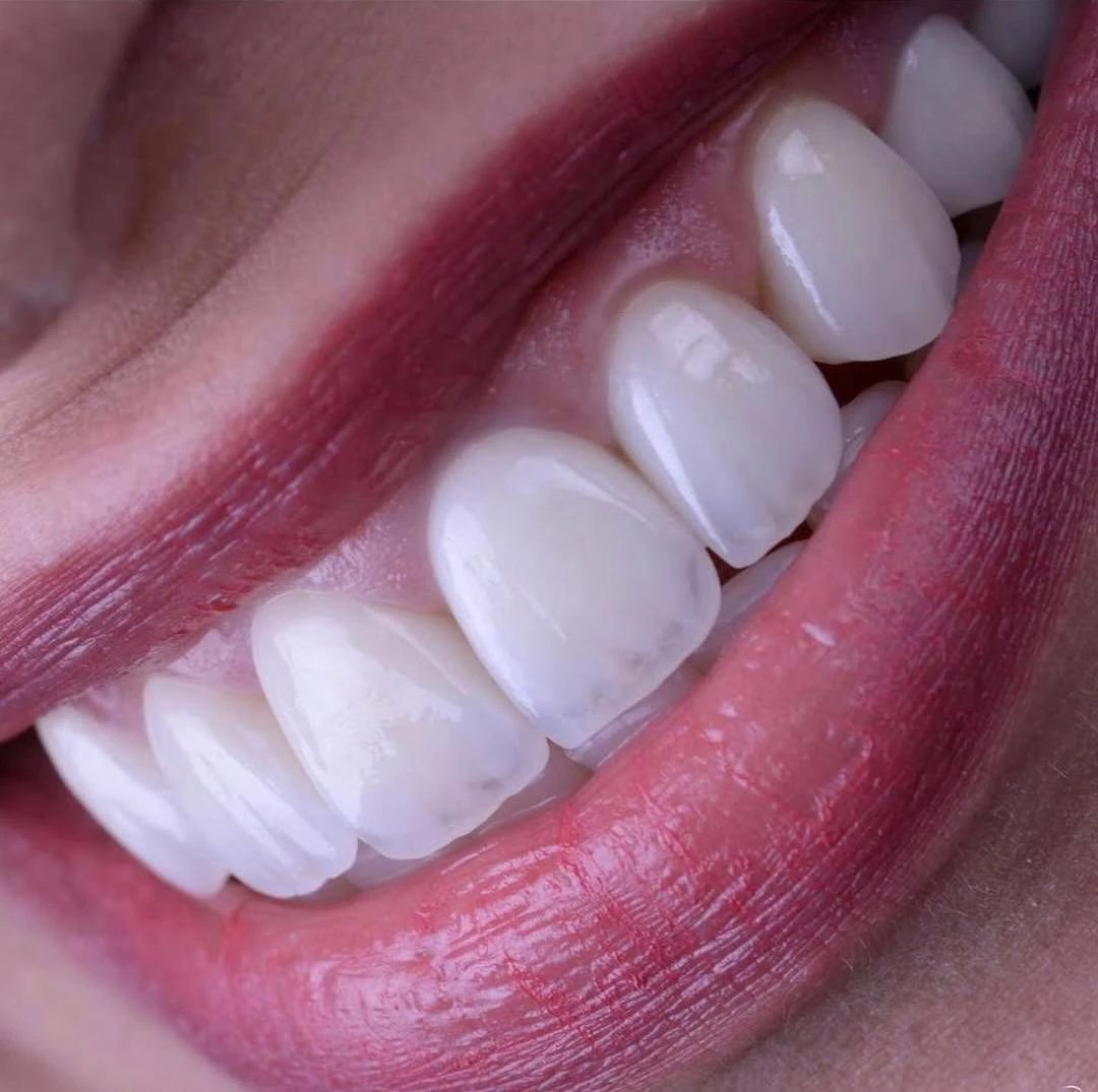 Estetik Implant Clinic, стоматология