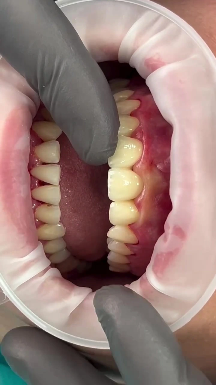 Mydent