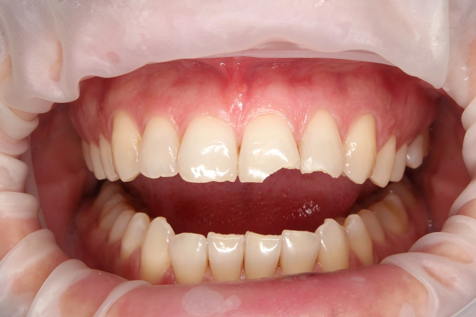 neoDental