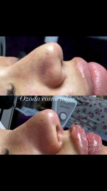 Ozoda