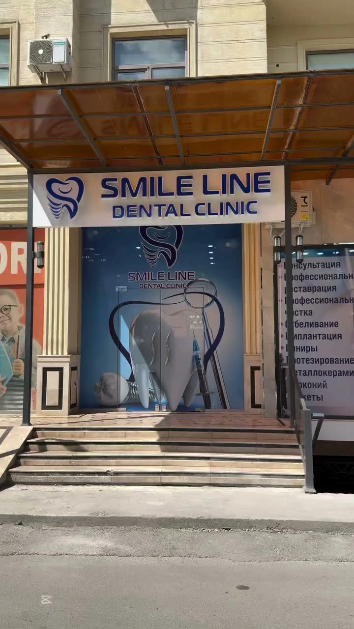 Smile line, стамотология