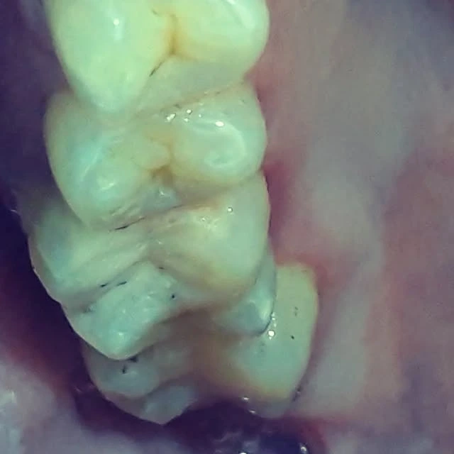 Stomalor