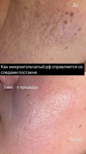 The face