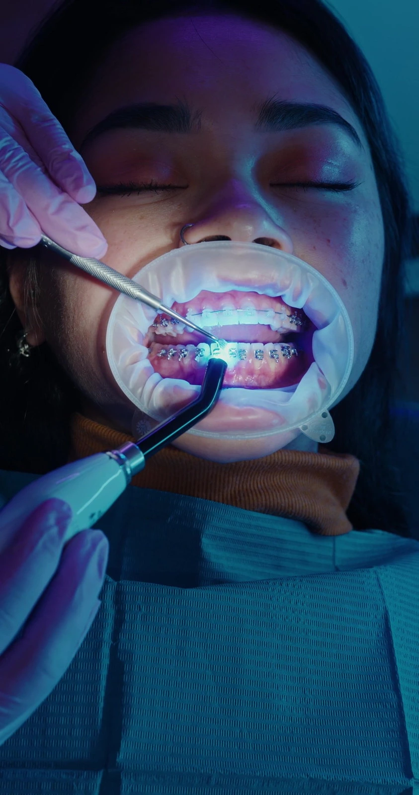 Tooth art