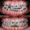 Xasan denta med