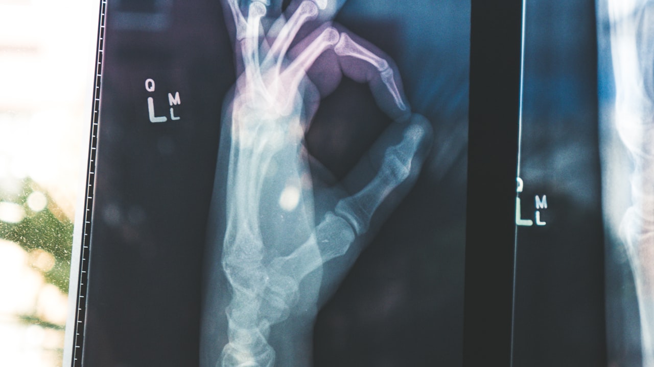 Orthopedics